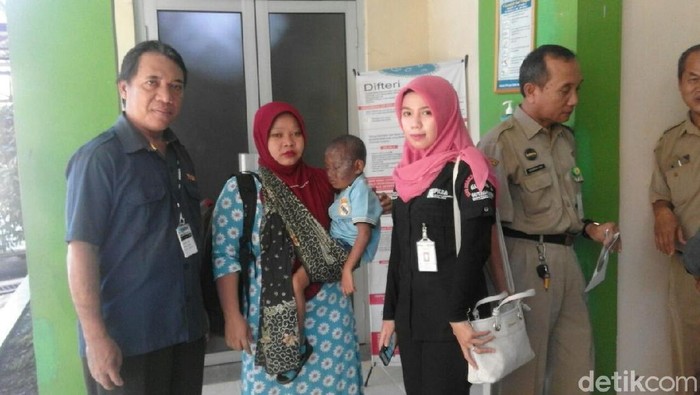 Bocah Penderita Kanker Kulit dan Tumor Mata Dirujuk ke Semarang