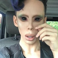 Vinny telah menjalani serangkaian prosedur kecantikan. Mulai dari berkali-kali filler di bagian alis, pipi, botox hingga operasi hidung. Perawatan kecantikan yang disebutkan tersebut tidak hanya dilakukan sekali namun berkali-kali. (Foto: Instagram)