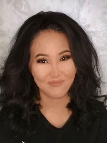 Lahir dengan Tahi Lalat Sewajah, Transformasi Wanita Ini Bikin Pangling