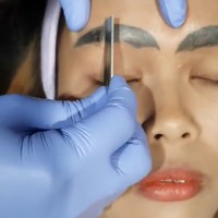 Butuh waktu berkali-kali untuk menghilangkan tato alisnya. Pertama-tama rambut alis dikerok terlebih dahulu agar sinar laser bisa langsung menembus kulit.  Foto: dok. Facebook