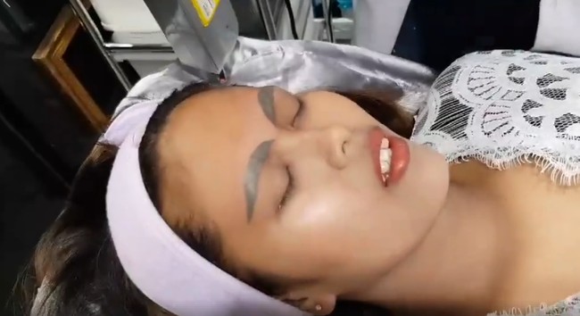 Vilailak mengaku bahwa biaya laser untuk menghilangkan tato alis tersebut tidak murah. Biayanya sekitar US$ 960 hingga US$ 1600. Namun Vilailak merasa bahagia bisa memberikan perawatan secara gratis untuk Kanyarat.  Foto: dok. Facebook