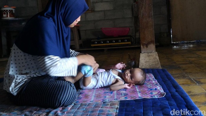 Balita di Boyolali Ini Jantungnya Bocor dan Harus Dioperasi