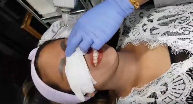 Beruntungnya Kanyarat karena fotonya yang viral. Terapis alis Vilailak Nan Sundantom iba dengan penampilan alisnya hingga menawarkannya untuk memperbaiki alis bentuk seperti siput itu.  Foto: dok. Facebook