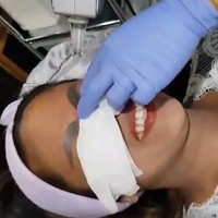 Beruntungnya Kanyarat karena fotonya yang viral. Terapis alis Vilailak Nan Sundantom iba dengan penampilan alisnya hingga menawarkannya untuk memperbaiki alis bentuk seperti siput itu.  Foto: dok. Facebook