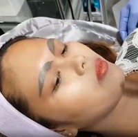 Kanyarat pun merasa beruntung Vilailak mau membantunya. Aku sangat senang dengan hasilnya. Aku merasa lebih baik dan cantik sekarang. Aku pikir aku akan hidup dengan alis tebal dan lebar. Kini aku hanya perlu bersabar untuk mendapatkan bentuk alis yang lebih baik lagi, kata Kanyarat.  Foto: dok. Facebook