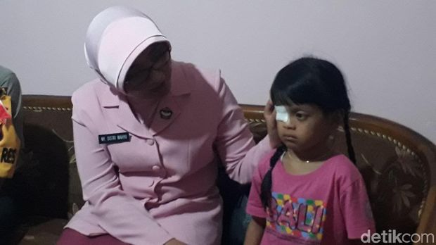 Meski menderita kanker mata, namun Keiko tetap beraktivitas seperti biasa