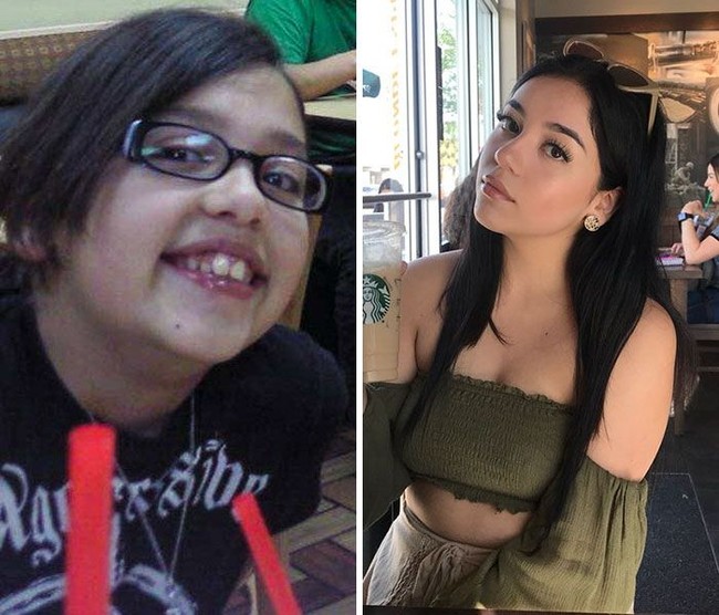 Transformasi wanita yang dulu culun sini jadi bukti semua wanita akan cantik pada masanya. Foto: Twitter/Instagram