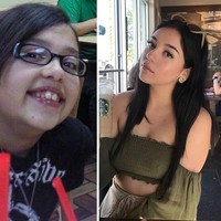 Transformasi wanita yang dulu culun sini jadi bukti semua wanita akan cantik pada masanya. Foto: Twitter/Instagram