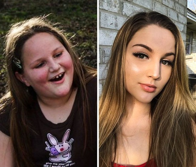 Banyak remaja yang dulunya chubby terlihat lebih langsing saat tumbuh besar. Wajah mereka pun jadi berubah. Foto: Twitter/Instagram