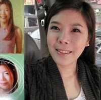 Beginilah penampilannya dulu sebelum rhinoplasty atau operasi hidung. Foto: ist