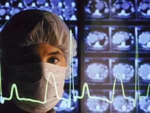 Soal Beringasnya Suporter Sepakbola, Dokter Jiwa Singgung Otak Primitif