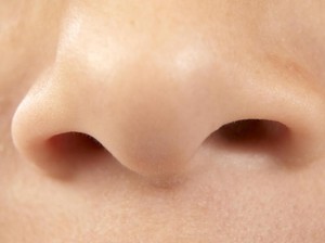 Gara-gara Penyakit Autoimun Langka, Hidung Wanita Ini Ambles