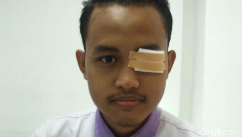 Viral Pemuda yang Matanya Infeksi Berat Karena Abu Rokok Pemotor Viral Pemuda yang Matanya Infeksi Berat Karena Abu Rokok Pemotor
