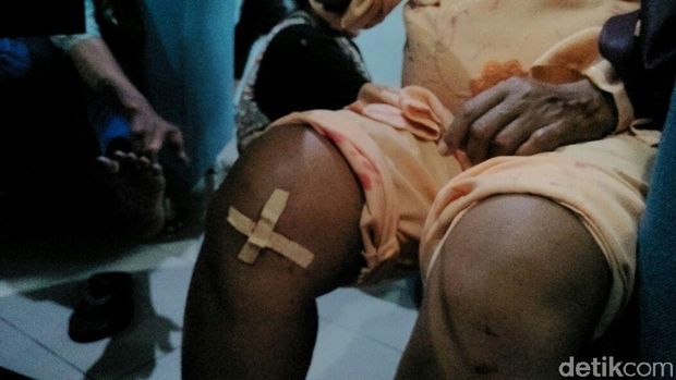 Warga terluka akibat aksi saling dorong ini. 