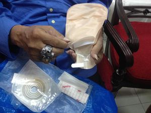 Susah Dapat Kantong Stoma, Pasien Kanker Sempat Gunakan Plastik Gula