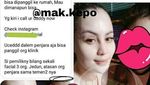 Disebut Perawatan di Penjara, Jennifer Dunn Makin Cantik?