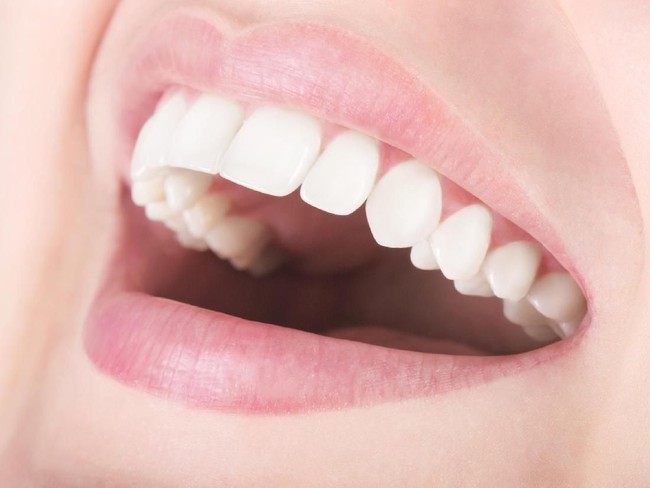 5 Cara Jaga Kesehatan Gigi dan Mulut untuk Hasilkan Senyum yang Menawan (2)