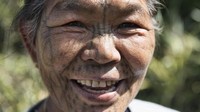 Pengalaman wanita itu menyebutkan rasanya begitu menyakitkan. Wajahnya terluka selama lima hari (Dave Stamboulis/BBC Travel)