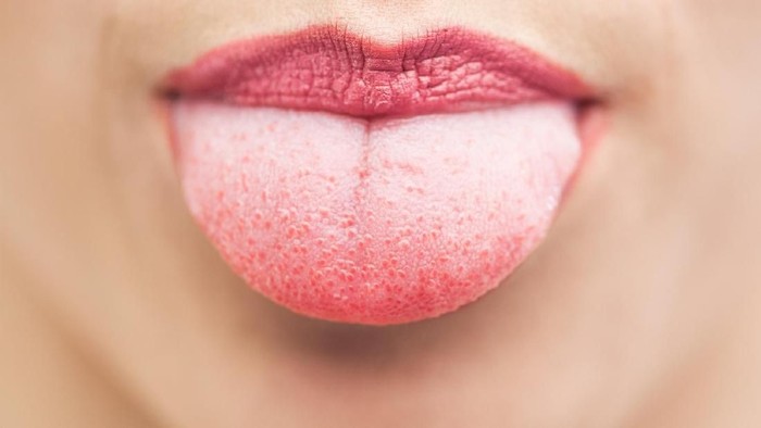 Foto: Thinkstock Foto: Thinkstock