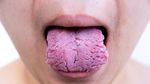 Menebak Kondisi Kesehatan Seseorang Lewat Lidah