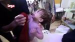 Potret Menyedihkan Anak-anak Korban Serangan Kimia di Suriah