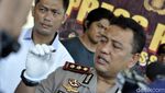 Ini Bentuk Peluru Pria Topeng yang Tak Tembus Tubuh Atikah
