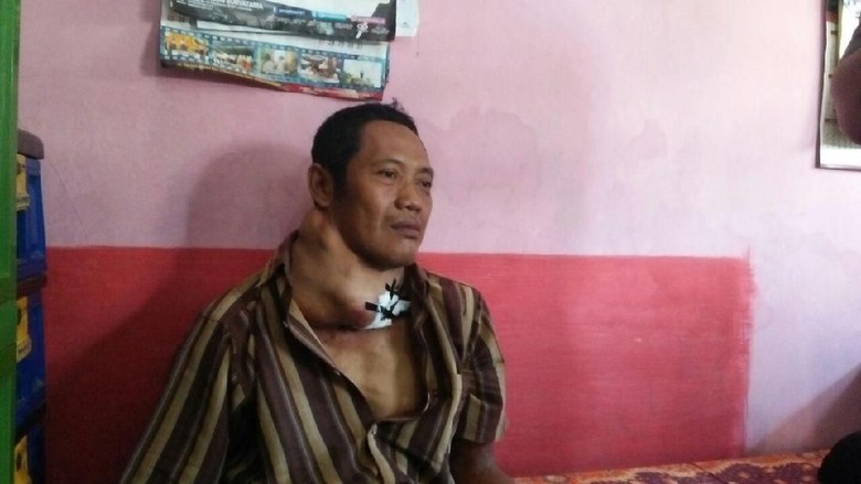 Derita Pria di Jombang yang 5 Tahun Sakit Kanker Tiroid Derita Pria di Jombang yang 5 Tahun Sakit Kanker Tiroid