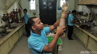 Untuk harga satu kaki palsu di rumah sakit rata-rata dijual seharga Rp 20 juta per buah. Sementara Yayasan Peduli Tuna Daksa memberikan kaki dan tangan palsu secara sukarela dan gratis bagi kalangan tidak mampu.