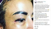 Namun netizen justru memberikan komentar nyinyir kepadanya. (Dok. Instagram/cynthiara_alona)