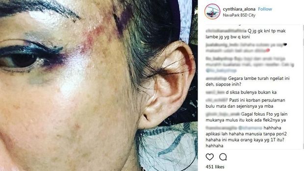Tak Mau Pindah Amerika, Alasan Cynthiara Alona Dianiaya Pacar