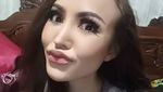 Komentar Manusia Tanpa Pori-pori di Instagram Cynthiara Alona