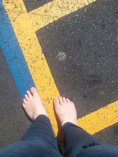 3 Tahun Nyeker Tak Pakai Sepatu, Kaki Kassandra Jadi Seperti Ini