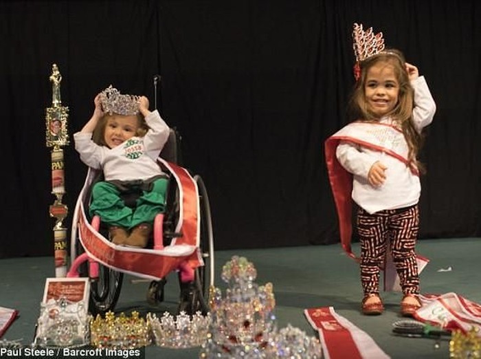 Disabilitas Fisik Tak Halangi Kakak Beradik Ini Berprestasi