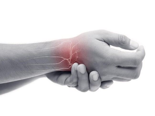 Tangan Sering Mati Rasa? Bisa Jadi 4 Ini Penyebabnya (2)