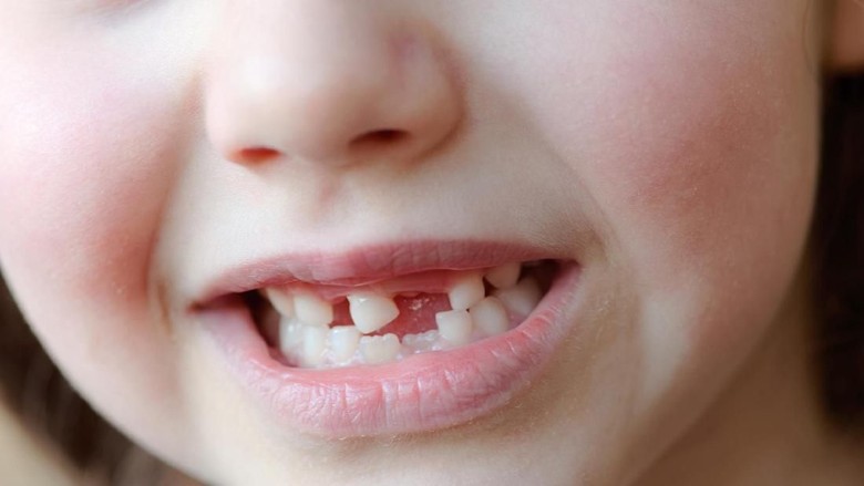 Anakku Kehilangan 3 Gigi Saat Pulang dari Daycare/ Foto: Thinkstock Anakku Kehilangan 3 Gigi Saat Pulang dari Daycare/ Foto: Thinkstock