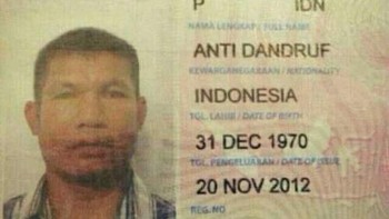 Orangtuanya mungkin dulu ketombean. (Foto: Internet)
