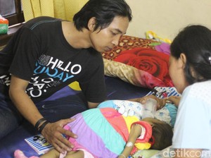 Tengok Evelin, Bayi 9 bulan yang Perutnya Membengkak