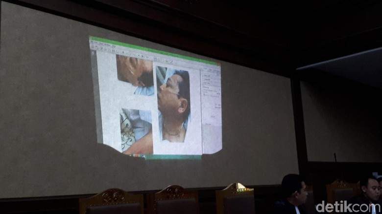 Jaksa KPK Tampilkan Visum Luka Setya Novanto di Sidang Jaksa KPK Tampilkan Visum Luka Setya Novanto di Sidang