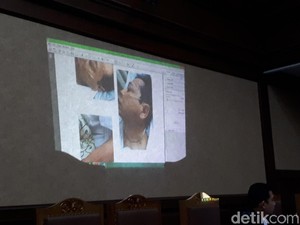 Jaksa KPK Tampilkan Visum Luka Setya Novanto di Sidang