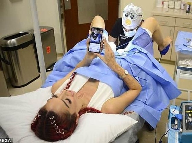 Ibu satu putri itu meremajakan area femininnya. Vagina setelah melahirkan tergantikan dengan vagina baru hari ini, tulis Farrah di video Instastory-nya. Foto: dok. Instagram