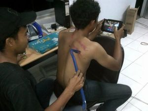7 Gambar Lucu Alat-alat Kesehatan Alternatif
