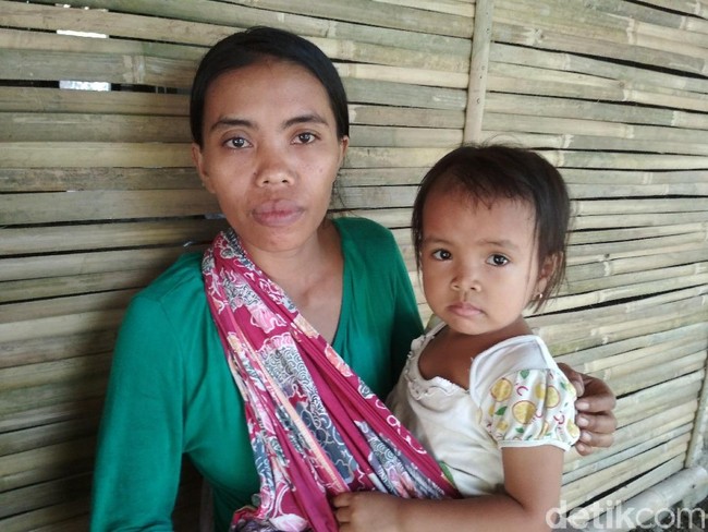 4 Dampak Besar Masalah Stunting Anak Bila Dibiarkan