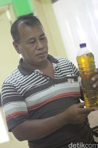 Cairan 3 Liter Dikeluarkan dari Perut Bayi yang Membengkak di Surabaya