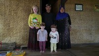 Kisah Walanda Sunda di Kampung Albino Ciburuy. Desa Ciburuy yang masuk dalam wilayah Kabupaten Bogor, Jawa Barat, mungkin menjadi salah satu desa dengan tingkat albinisme tertinggi di Indonesia. Tidak ada yang tahu mengapa hal itu terjadi. Salah satu warga Nana Suryana sadar bahwa leluhurnya ada yang mengalami kondisi albino. Salah satu kakek buyutnya adalah orang kulit putih. Mereka telah tinggal di desa itu selama ratusan tahun. Foto: Australia Plus ABC