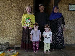 Kisah Walanda Sunda di Kampung Albino Ciburuy