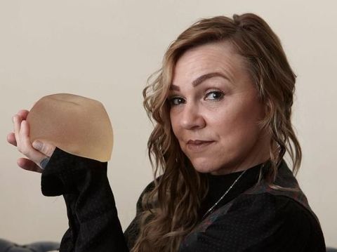 Wanita yang Melepas Implan Payudara Sendiri Pakai Cutter. 