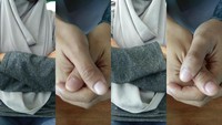 Percaya atau tidak, tangan dan jari bisa menunjukan kepribadianmu. Sekarang coba perhatikan tangan mana yang ada di atas saat menyilangkan tangan di depan dada dan jempol mana yang berada di atas saat menggenggam. (Foto: detikcom)