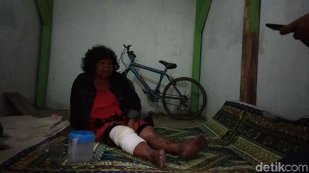 Cerita Horor Korban Luka Ledakan Gas 'Melon' Bandung