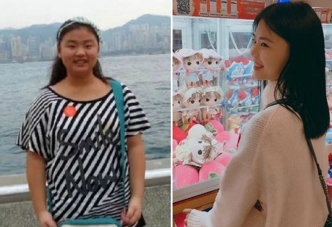 Yahan, seorang siswa dari Hunan, China memiliki bobot tubuh empat kilogram ketika ia lahir, yang lebih berat dari bayi normal. Ia menjadi sangat suka makan setelah masuk sekolah dasar. Ketika anak-anak lain umumnya memiliki berat 35 hingga 40 kilogram, Yahan memiliki berat lebih dari 60 kilogram. Foto: Weibo