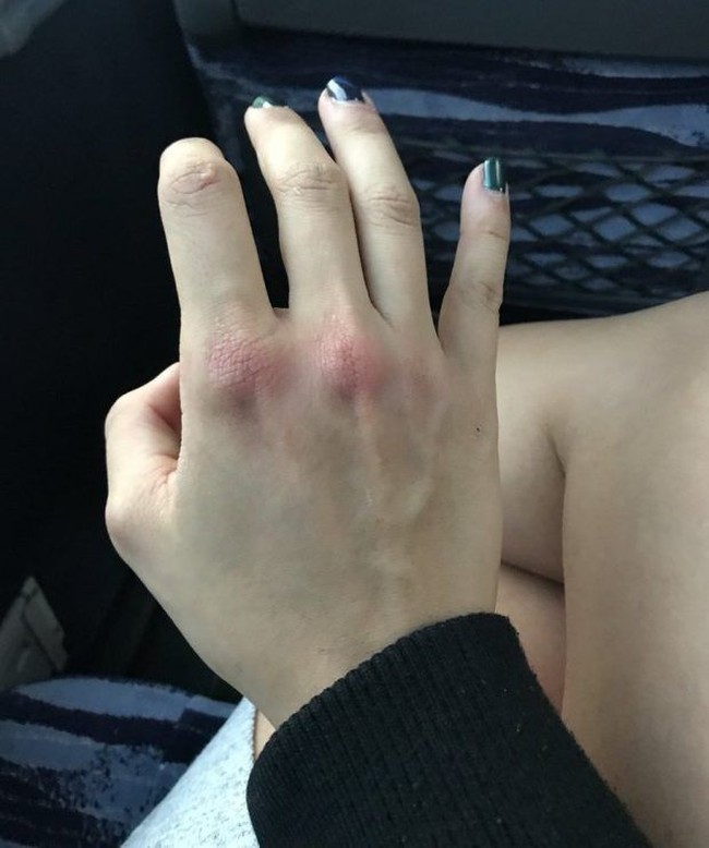 Aku menonjoknya di rahang, dengan kencang, ujar Leanna. Foto: Instagram/@leanna_carr